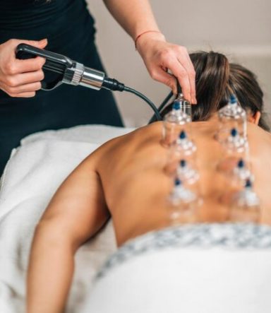 Schröpfen – traditionelle Anwendung zur Entlastung von Muskulatur und Gewebe.